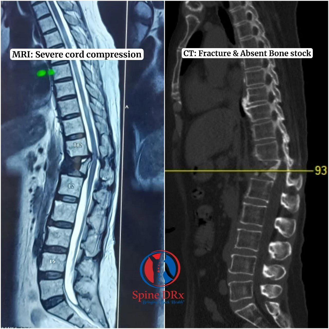 MRI & CT