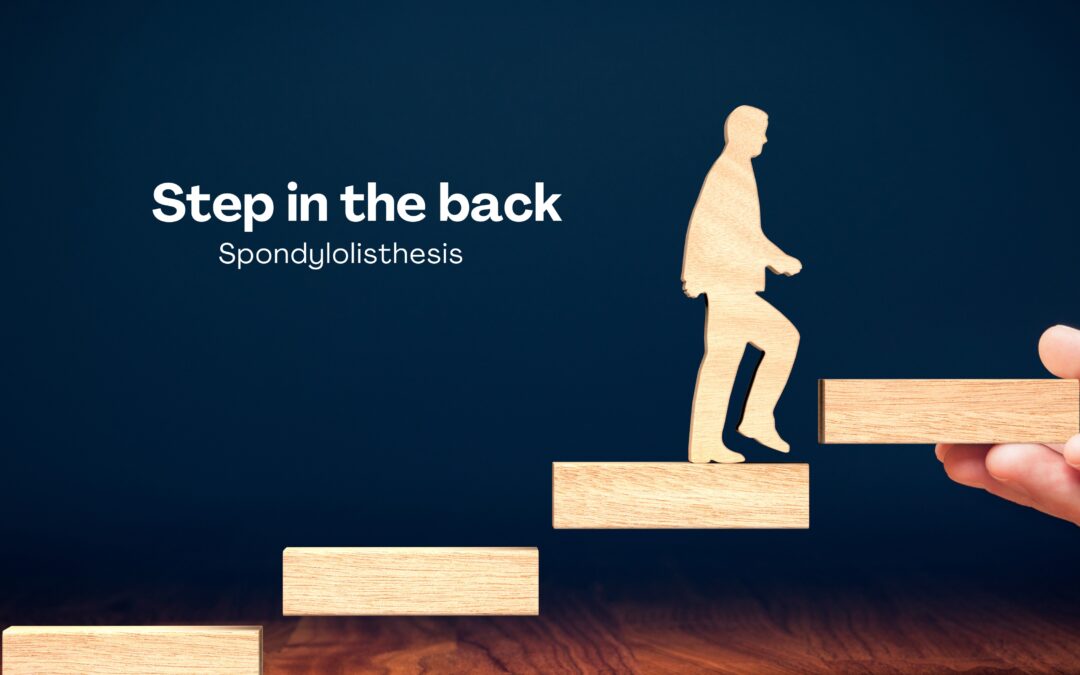 Spine & Step