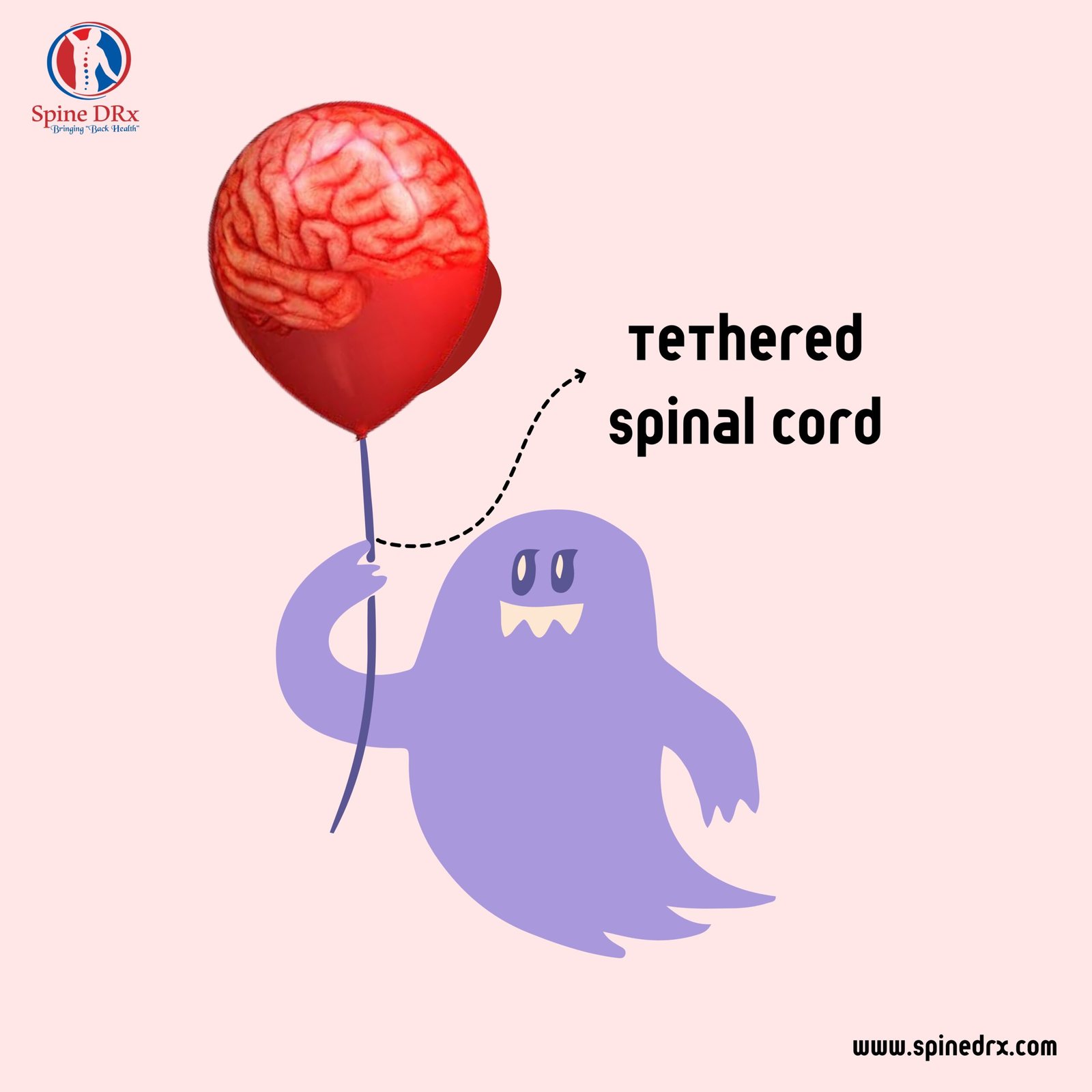 Spine & Tethered Spinal cord