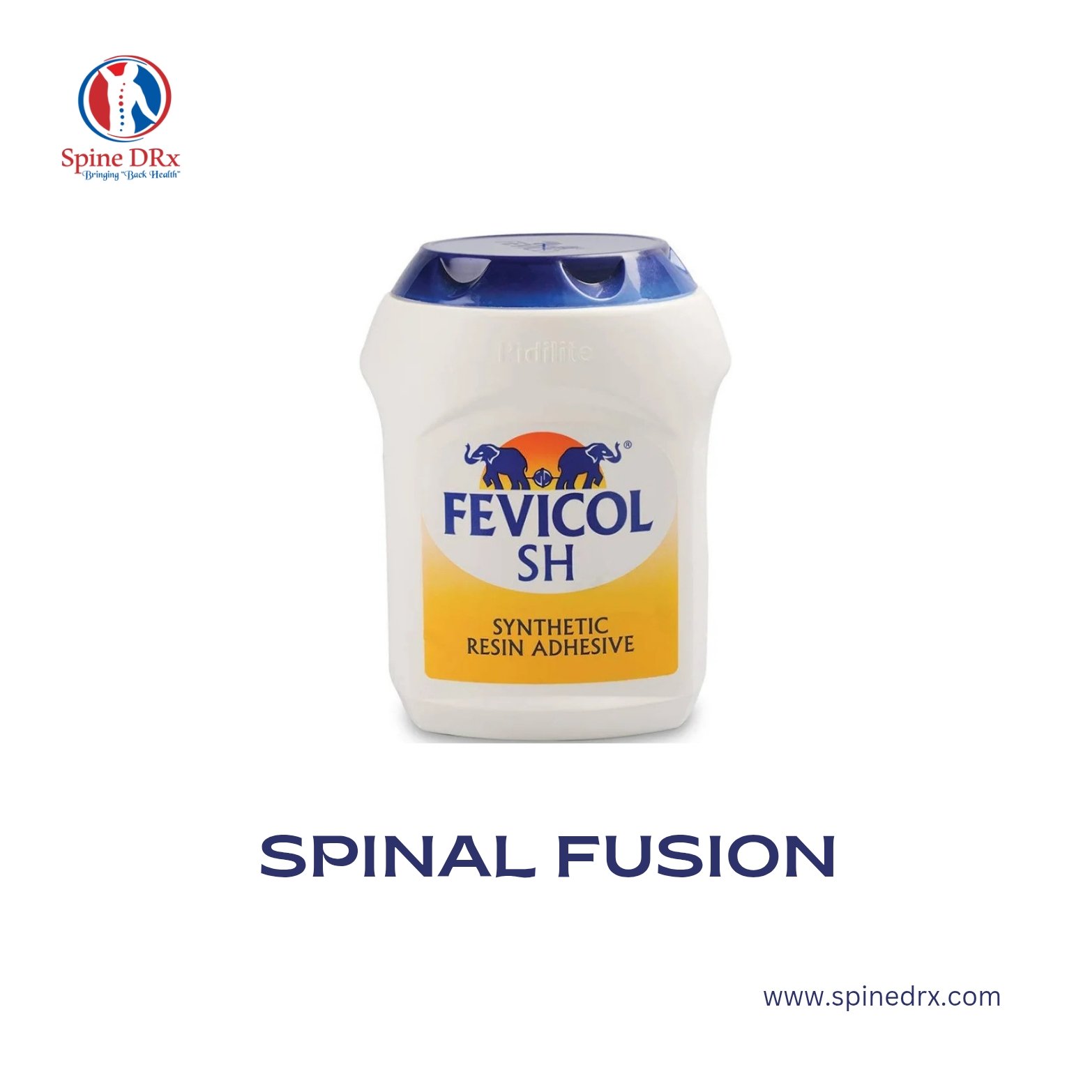 Spine & Glue