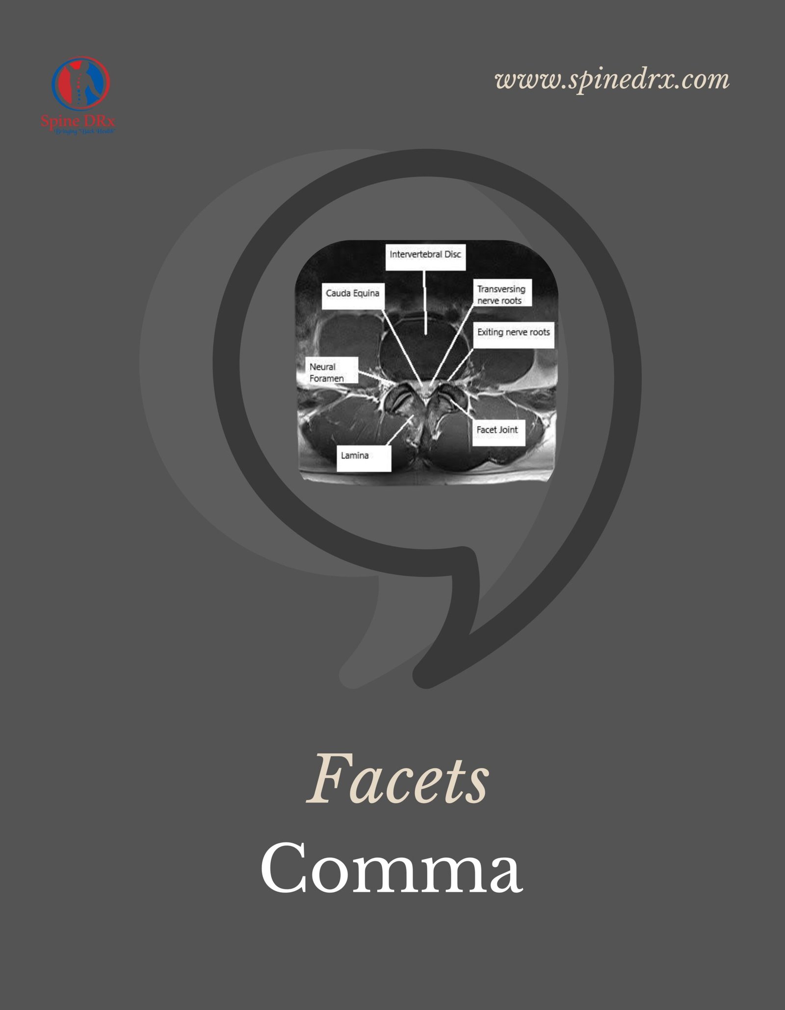 Spine & Comma shaped Facets