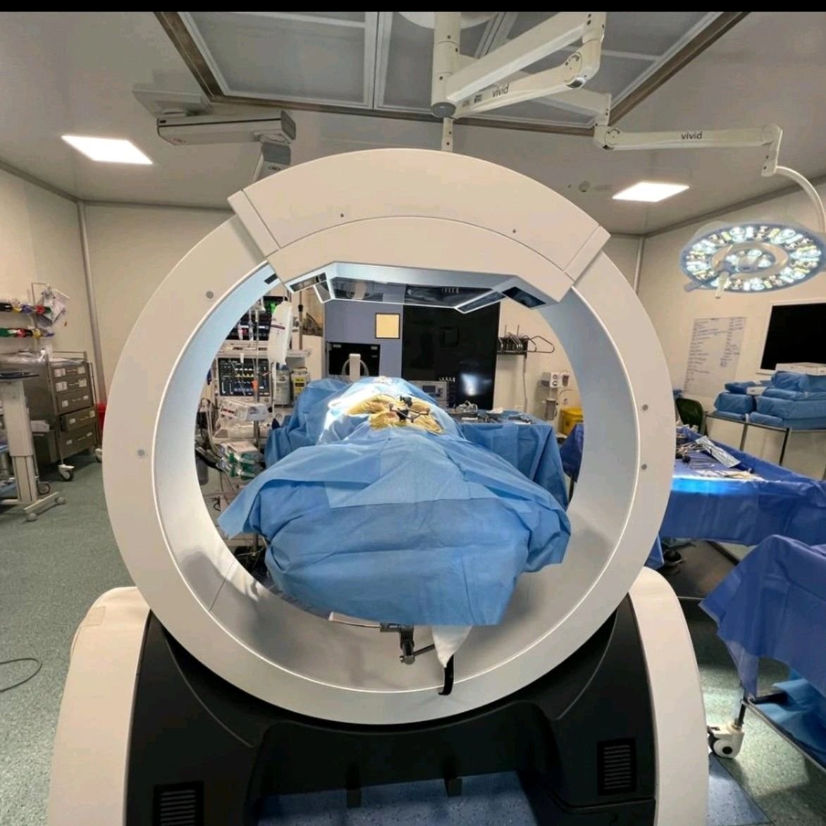 Navigation Spine surgery : Revision made simple