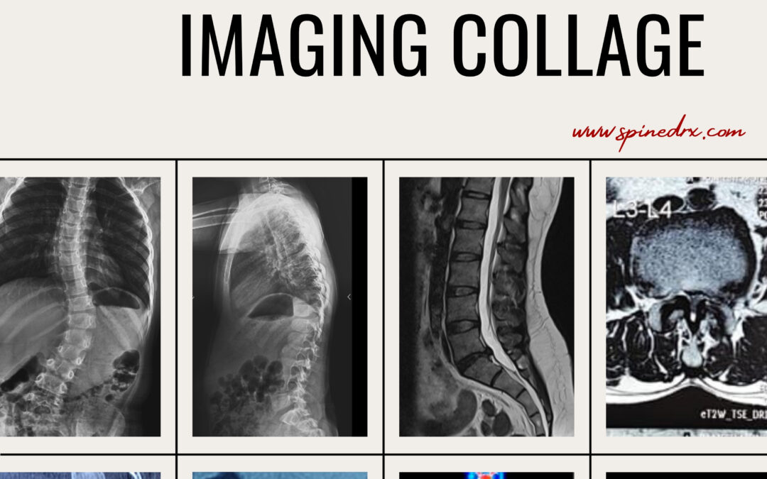 Spine & Imaging&nbsp;