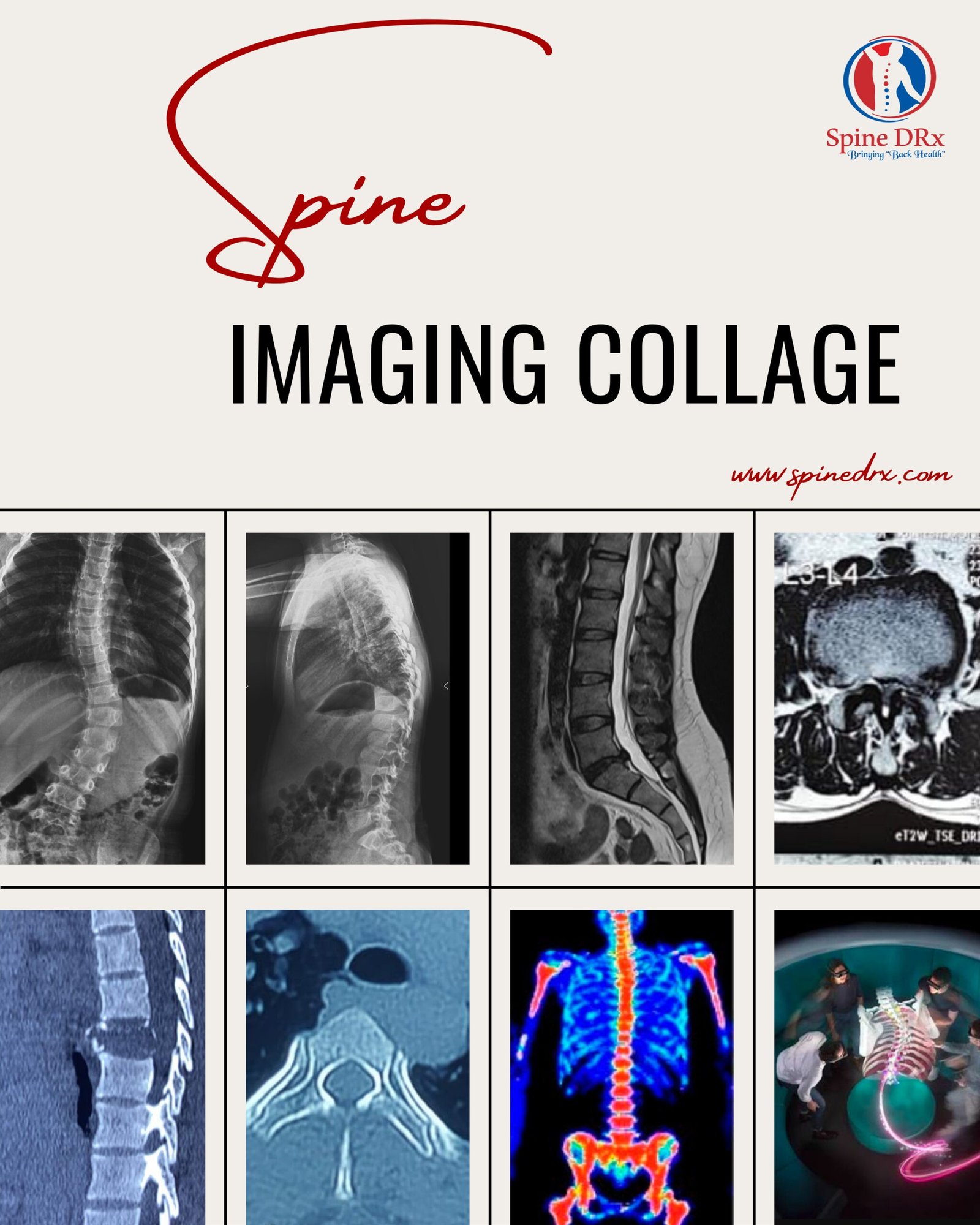 Spine & Imaging&nbsp;
