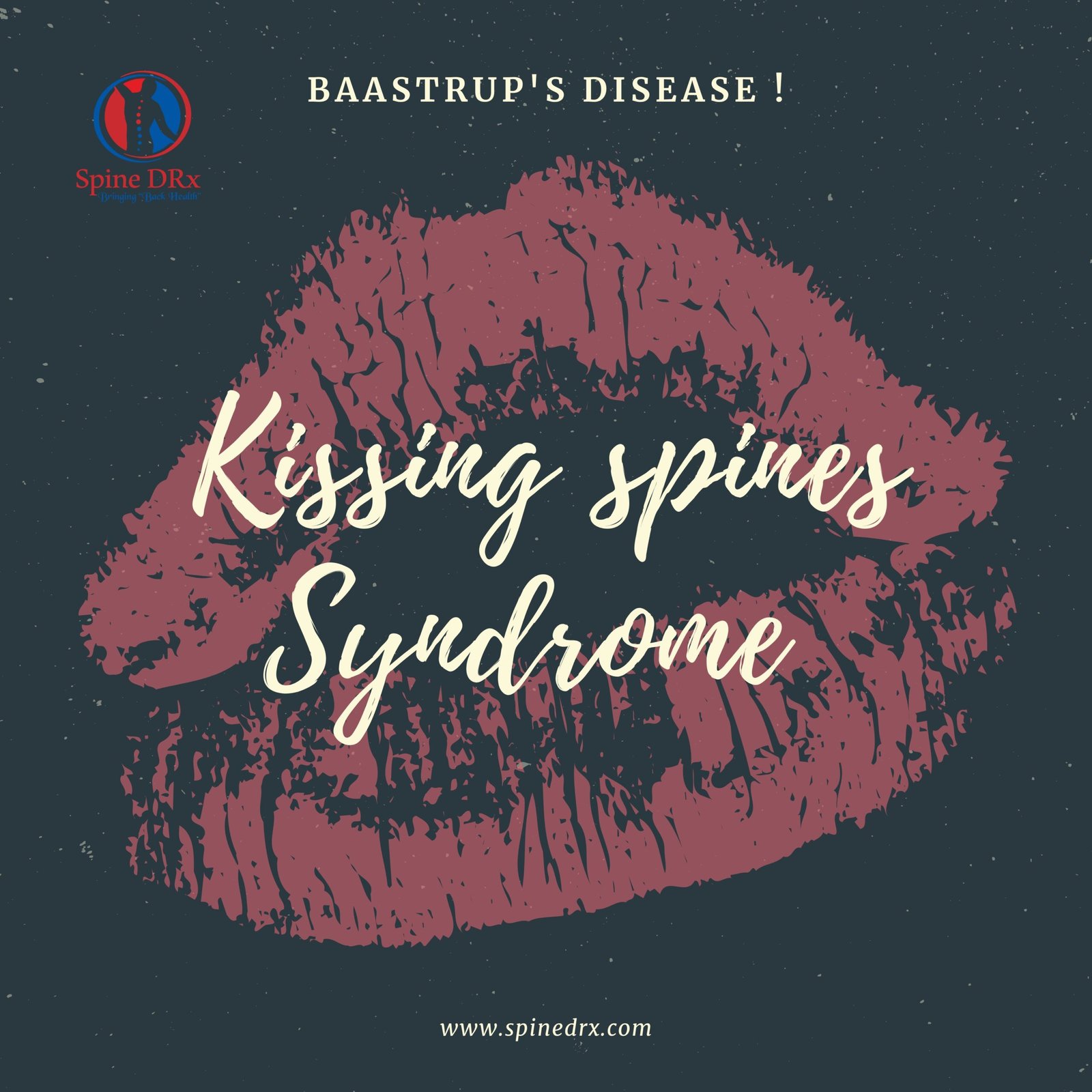 Kissing Spines Syndrome