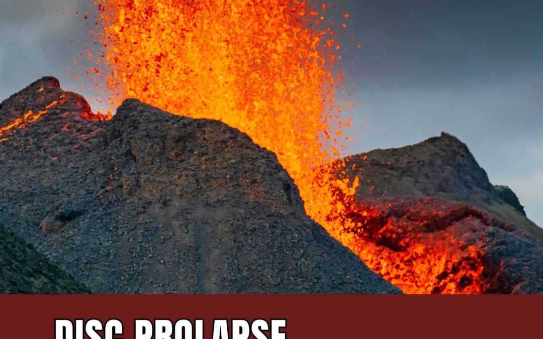 Spine & Volcano