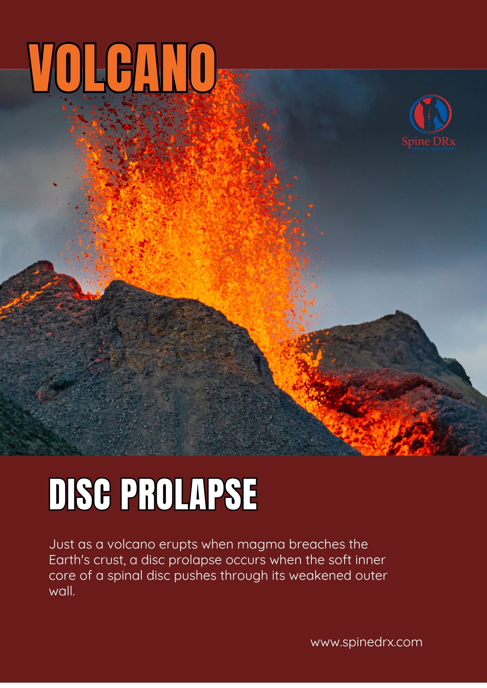 Spine & Volcano