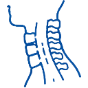 Cervical Myelopathy Neck spinal cord disorder condition