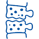 Osteoporotic Fractures Weak bone vertebral compression fracture