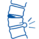 Slipped Disc Slipped disc spinal condition