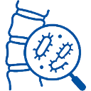 Spinal Infections & Spondylodiscitis Spine infection inflammatory disorder
