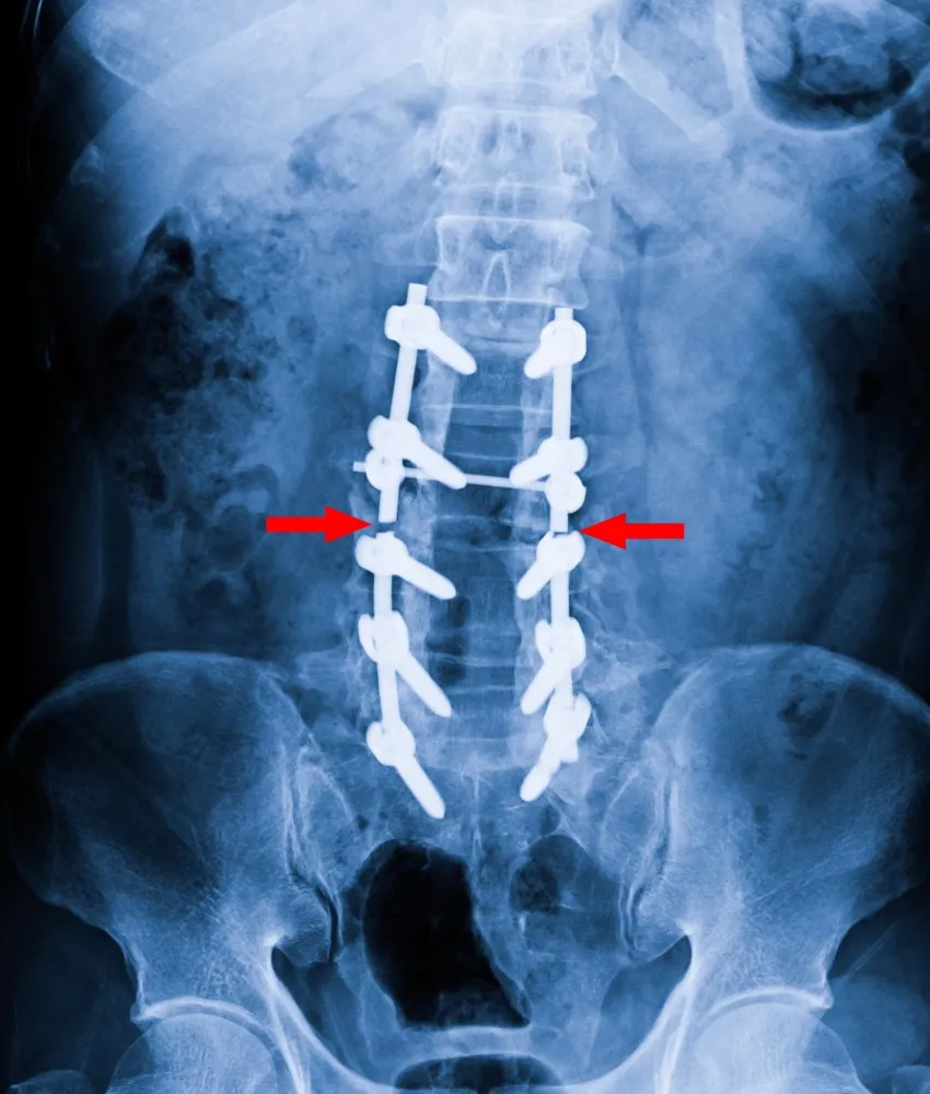 spine